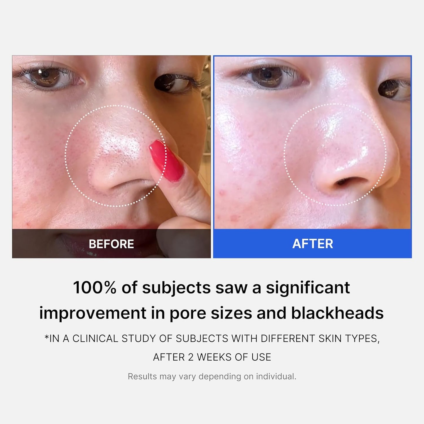 MEDICUBE Zero Pore Pad 155g